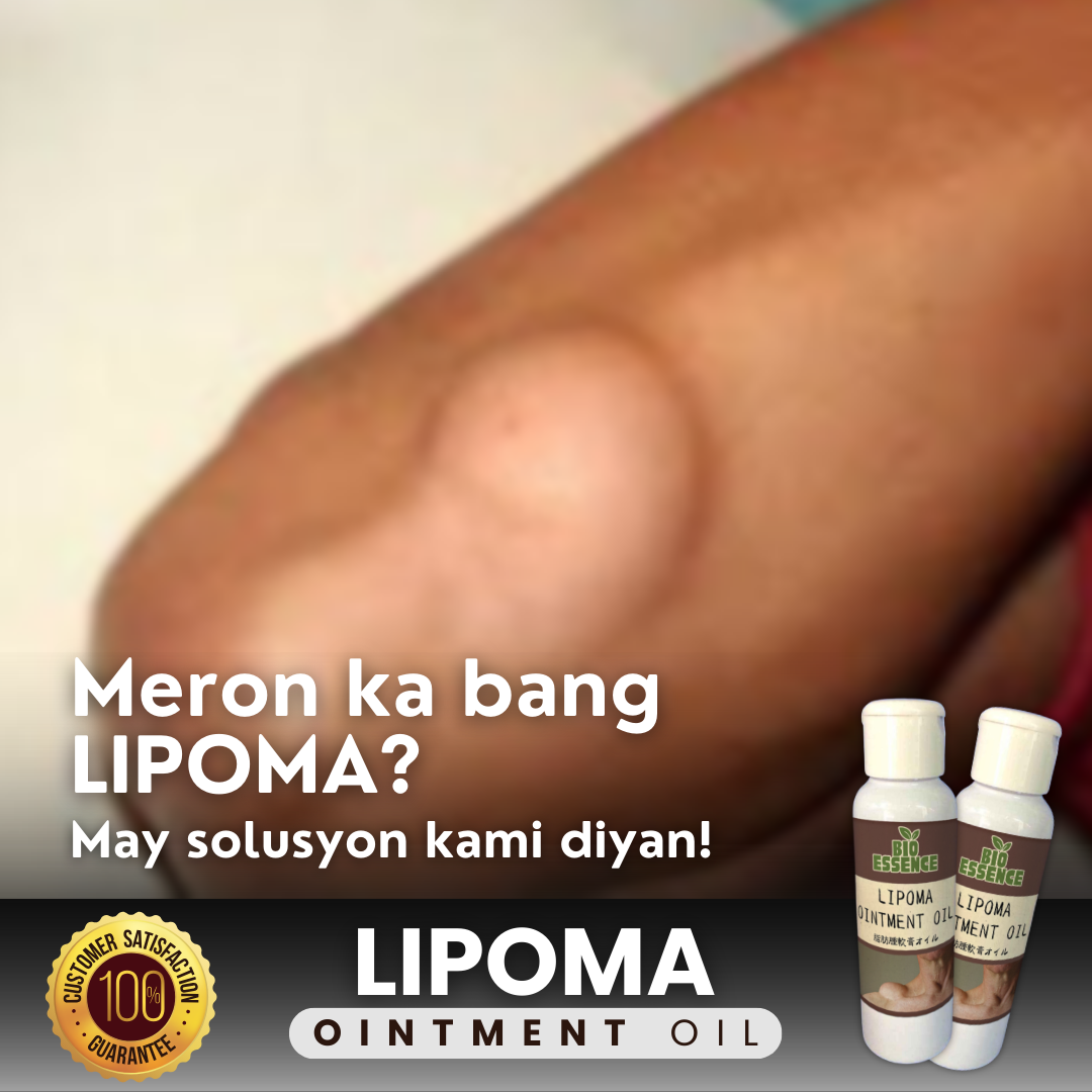 Lipoma Ointment Oil