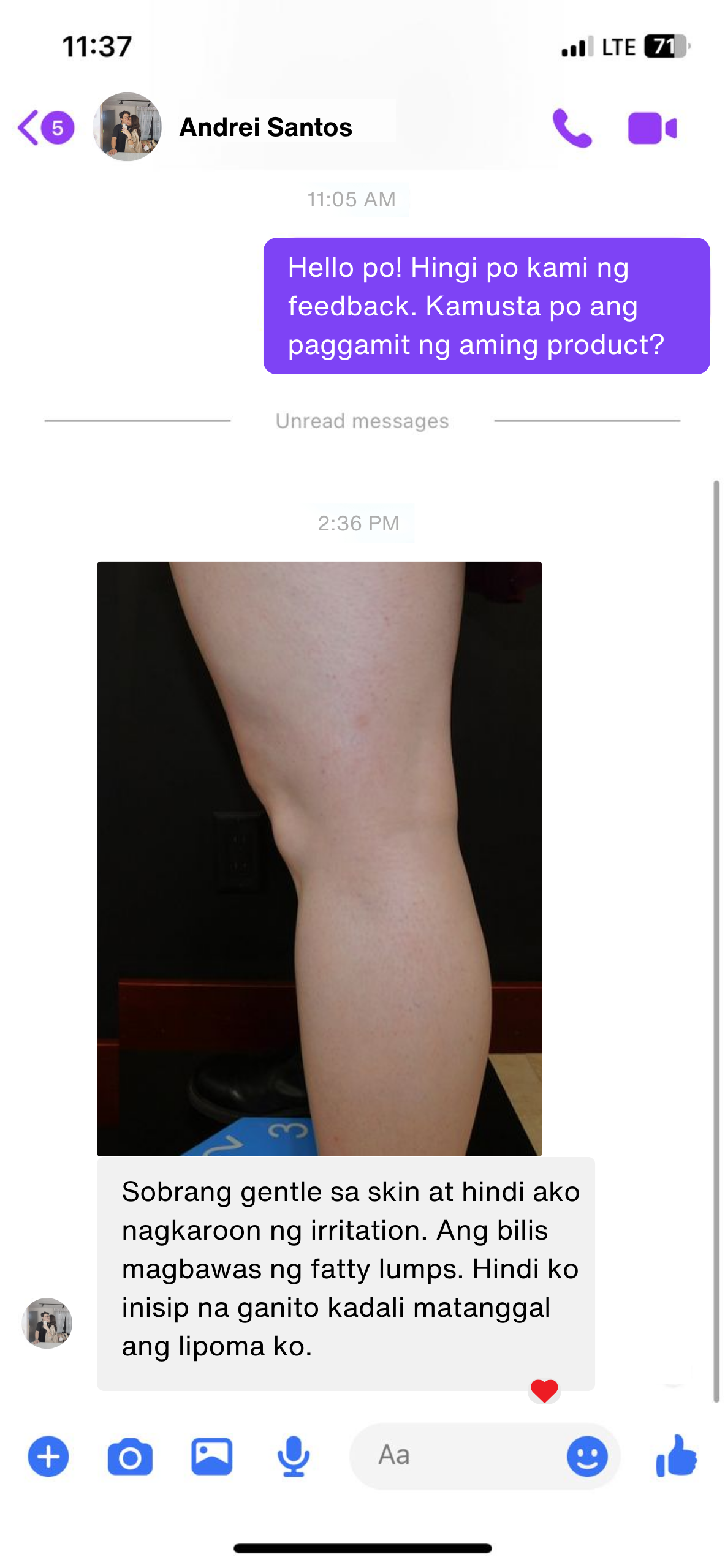 Lipoma Ointment Oil