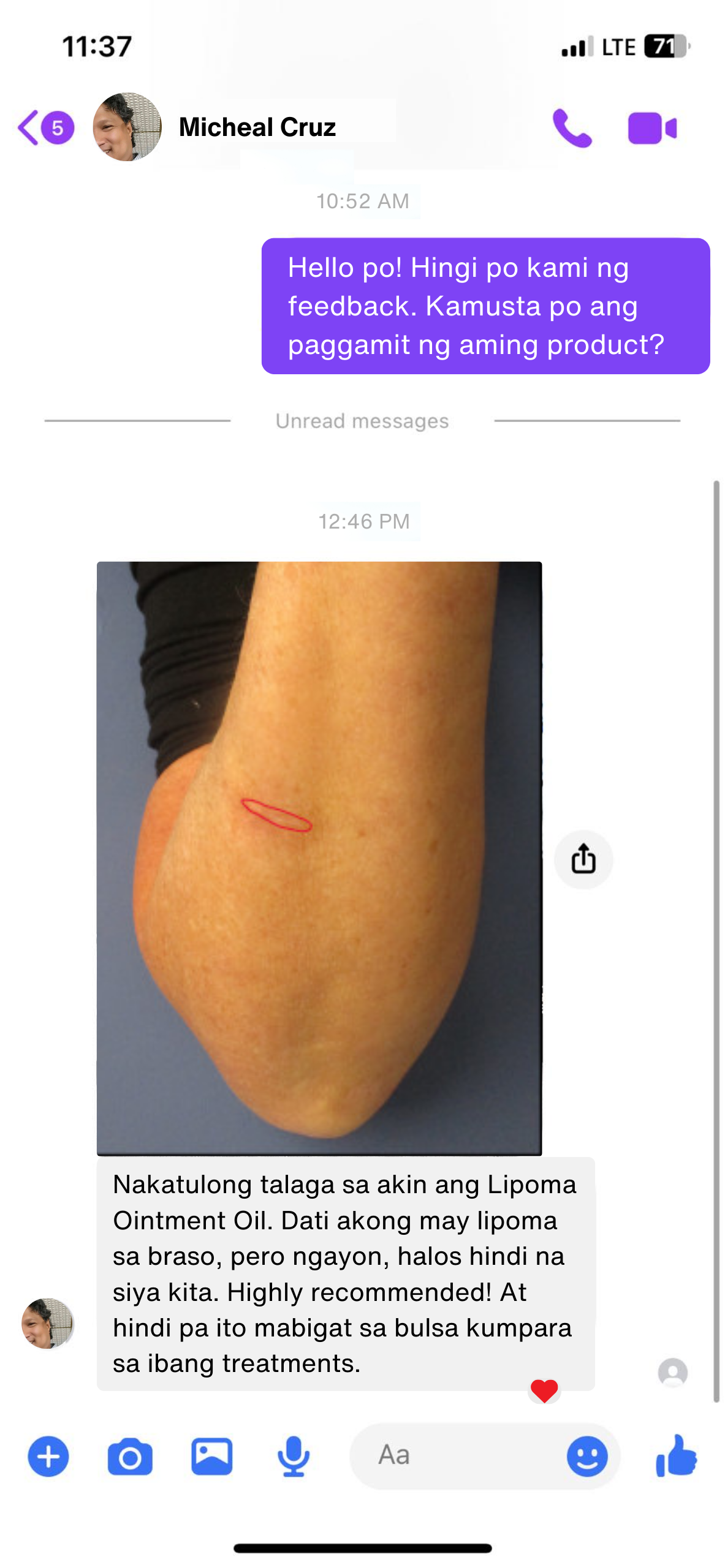 Lipoma Ointment Oil