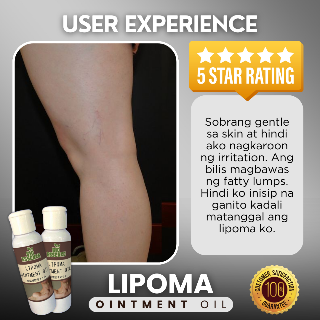 Lipoma Ointment Oil