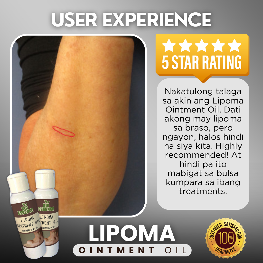 Lipoma Ointment Oil