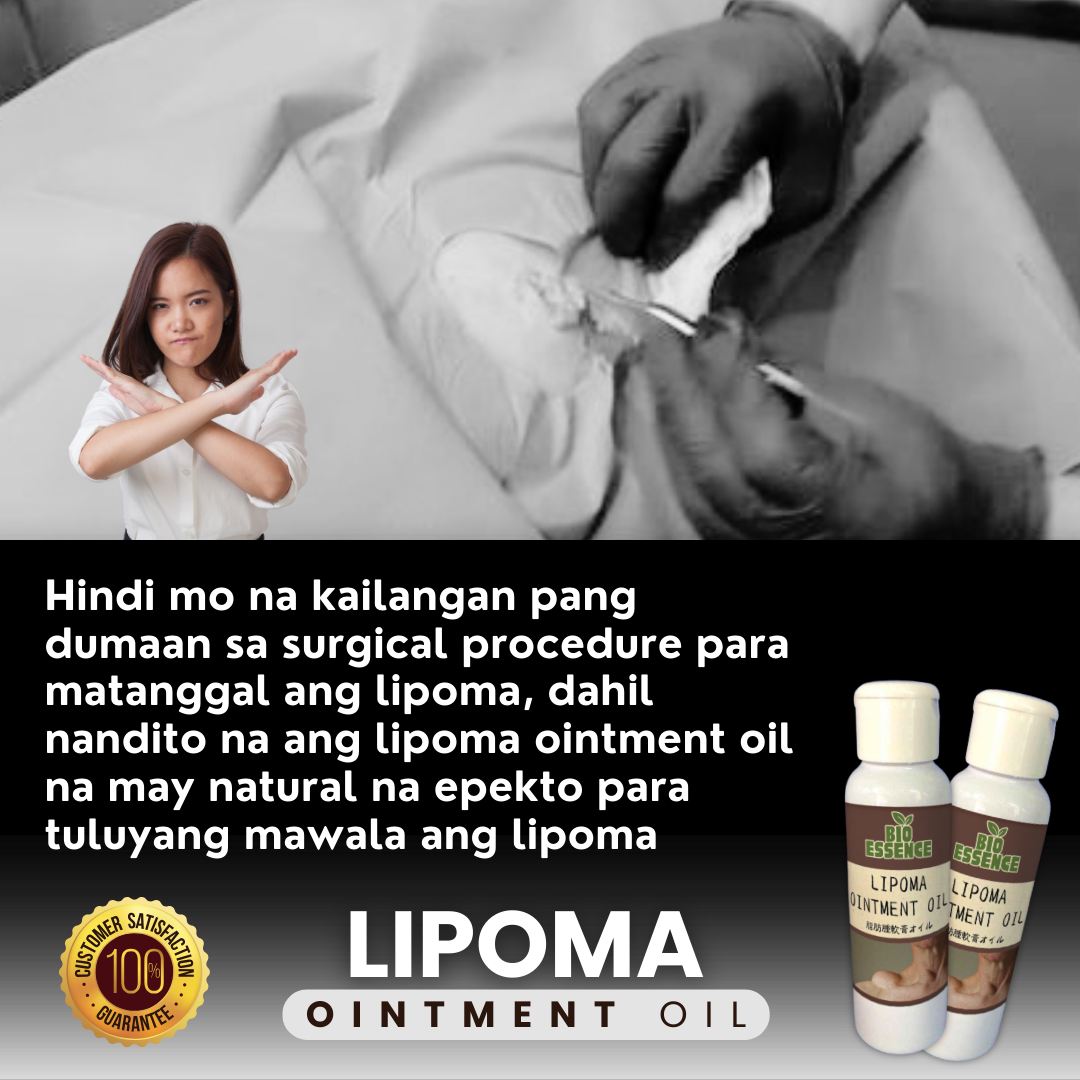 Lipoma Ointment Oil