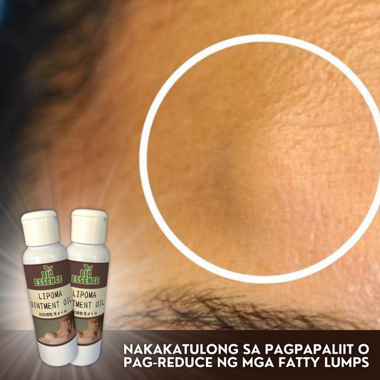 Lipoma Ointment Oil